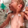 14-the-poor-little-guy-had-to-go-to-the-nicu-right-after-he-was-born